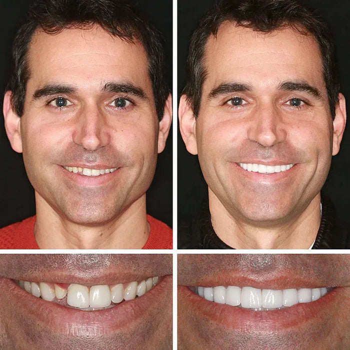 Smile result display