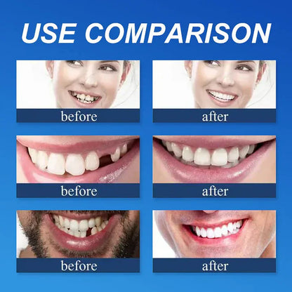 ⏰Ends Today: 50% OFF!  🏆2026 Bestselling Product🦷 Fit for a Fresh Smile, Say Goodbye to Wearing Discomfort!🌎