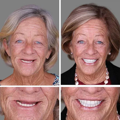 ⏰Ends Today: 50% OFF!  🏆2026 Bestselling Product🦷 Fit for a Fresh Smile, Say Goodbye to Wearing Discomfort!🌎