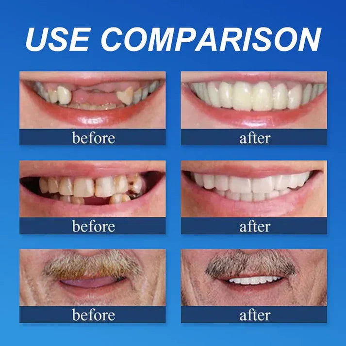 Denture use comparison before and after