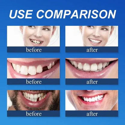 ⏰Ends Today: 50% OFF! 🌎KLENIMORE™ Custom-Fit — Designed for Comfort and a Natural-Looking Smile